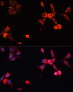 HSP70 Antibody in Immunocytochemistry (ICC/IF)