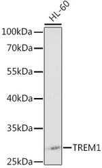 TREM-1 Antibody in Western Blot (WB)