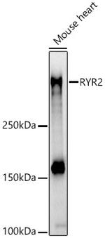 RyR2 Polyclonal Antibody