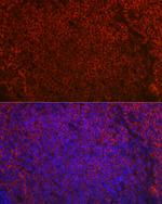 CD79a Antibody in Immunohistochemistry (Paraffin) (IHC (P))