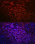 CD79a Antibody in Immunohistochemistry (Paraffin) (IHC (P))