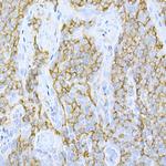 CD44 Antibody in Immunohistochemistry (Paraffin) (IHC (P))