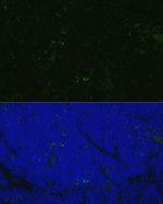 CD4 Antibody in Immunocytochemistry (ICC/IF)