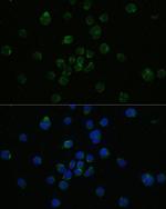 CD4 Antibody in Immunocytochemistry (ICC/IF)