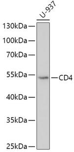 CD4 Antibody in Western Blot (WB)