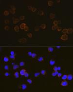 CD45 Antibody in Immunocytochemistry (ICC/IF)