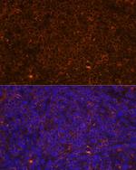 CD45 Antibody in Immunocytochemistry (ICC/IF)