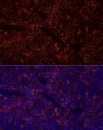 CD45 Polyclonal Antibody