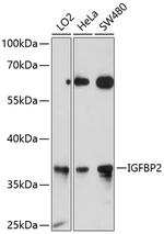 IGFBP2 Antibody in Western Blot (WB)