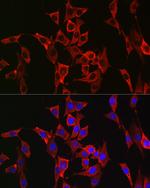 FGFR3 Polyclonal Antibody