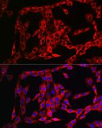 FGFR3 Antibody in Immunocytochemistry (ICC/IF)