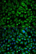 eIF4E Polyclonal Antibody