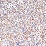PKC delta Antibody in Immunohistochemistry (Paraffin) (IHC (P))