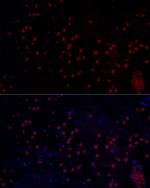 n-Myc Antibody in Immunohistochemistry (Paraffin) (IHC (P))