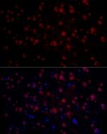 n-Myc Antibody in Immunohistochemistry (Paraffin) (IHC (P))
