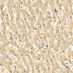 RelB Polyclonal Antibody