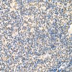 RelB Antibody in Immunohistochemistry (Paraffin) (IHC (P))