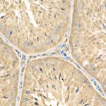 RelB Antibody in Immunohistochemistry (Paraffin) (IHC (P))