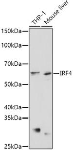 IRF4 Polyclonal Antibody