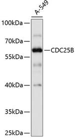 CDC25B Polyclonal Antibody