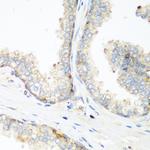 NEDD4 Polyclonal Antibody