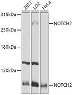 NOTCH2 Antibody in Western Blot (WB)