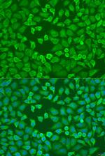 eIF3a Polyclonal Antibody