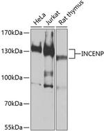 INCENP Polyclonal Antibody