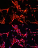 GSK3 alpha Polyclonal Antibody