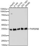 DcR3 Polyclonal Antibody