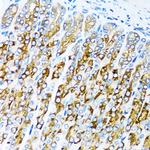 ACVR1C Polyclonal Antibody