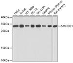 SMNDC1 Polyclonal Antibody