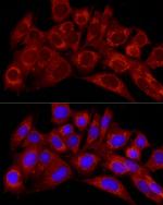 Endothelin 1 Polyclonal Antibody