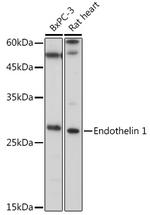 Endothelin 1 Antibody in Western Blot (WB)