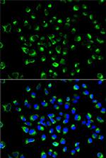 PDI Antibody in Immunocytochemistry (ICC/IF)
