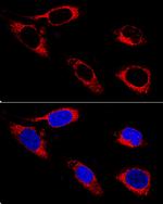 PDI Antibody in Immunocytochemistry (ICC/IF)