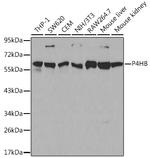 PDI Antibody in Western Blot (WB)