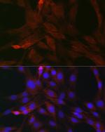 SOCS3 Antibody in Immunocytochemistry (ICC/IF)