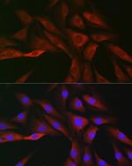 SOCS3 Polyclonal Antibody