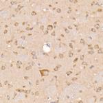 SOCS3 Antibody in Immunohistochemistry (Paraffin) (IHC (P))
