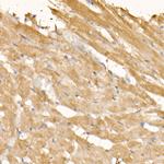 SOCS3 Antibody in Immunohistochemistry (Paraffin) (IHC (P))