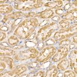 SOCS3 Antibody in Immunohistochemistry (Paraffin) (IHC (P))