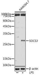 SOCS3 Antibody in Western Blot (WB)