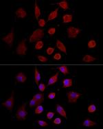 MMP7 Antibody in Immunocytochemistry (ICC/IF)