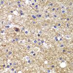 CDK6 Antibody in Immunohistochemistry (Paraffin) (IHC (P))