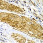 CDK6 Antibody in Immunohistochemistry (Paraffin) (IHC (P))