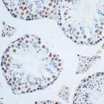 HMGB1 Antibody in Immunohistochemistry (Paraffin) (IHC (P))