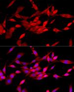 c-Cbl Antibody in Immunocytochemistry (ICC/IF)