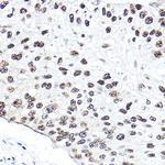 NBS1 Polyclonal Antibody