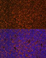 PTCH Polyclonal Antibody